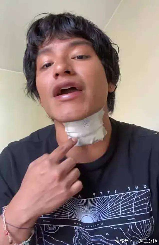 演出遭电击演出行业安全底线不容失守九游会j9ag舞台惊魂：21岁歌手(图3)